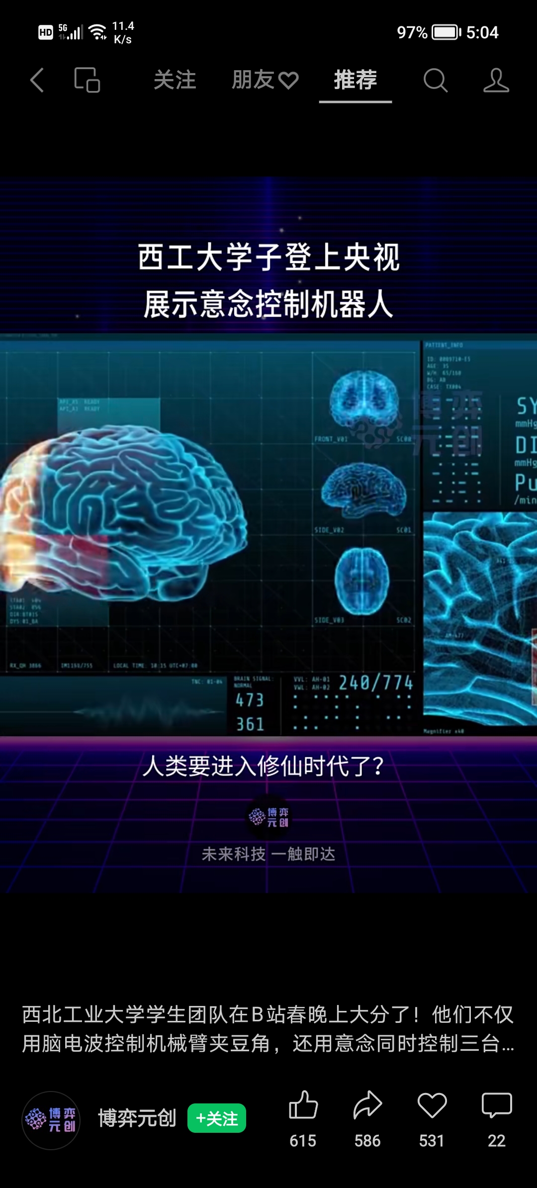 多路线齐头并进 脑机接口产业化进程加速