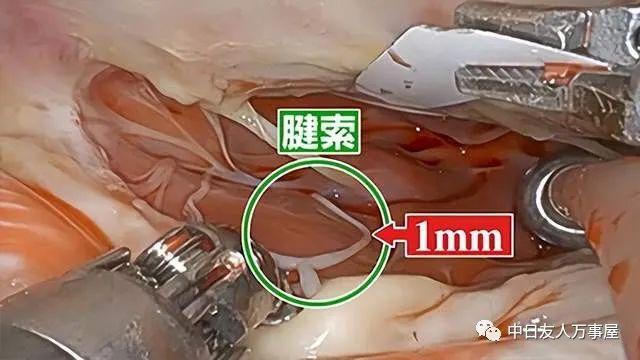 同益中：机器人腱绳方面仍在与下游客户送样沟通优化阶段