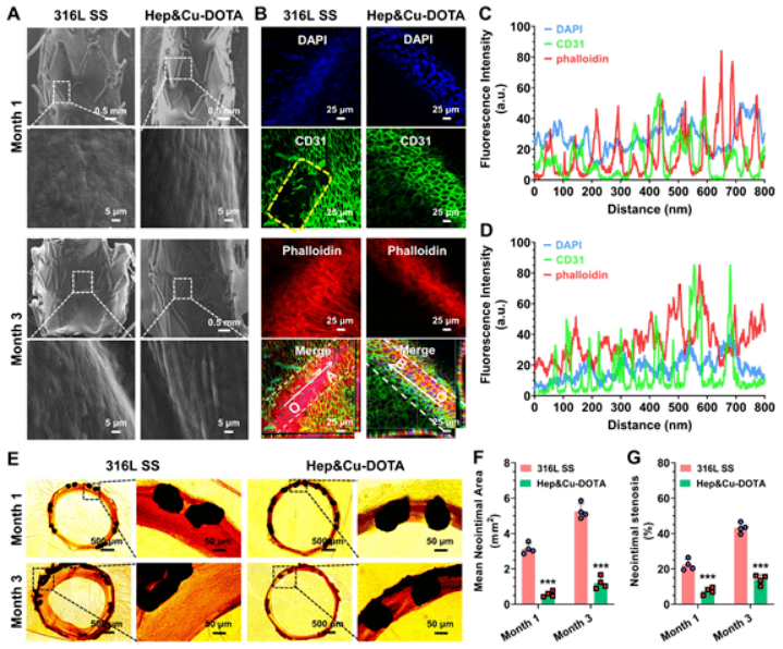 心脉医疗获得实用新型专利授权：“血管支架以及支架系统”