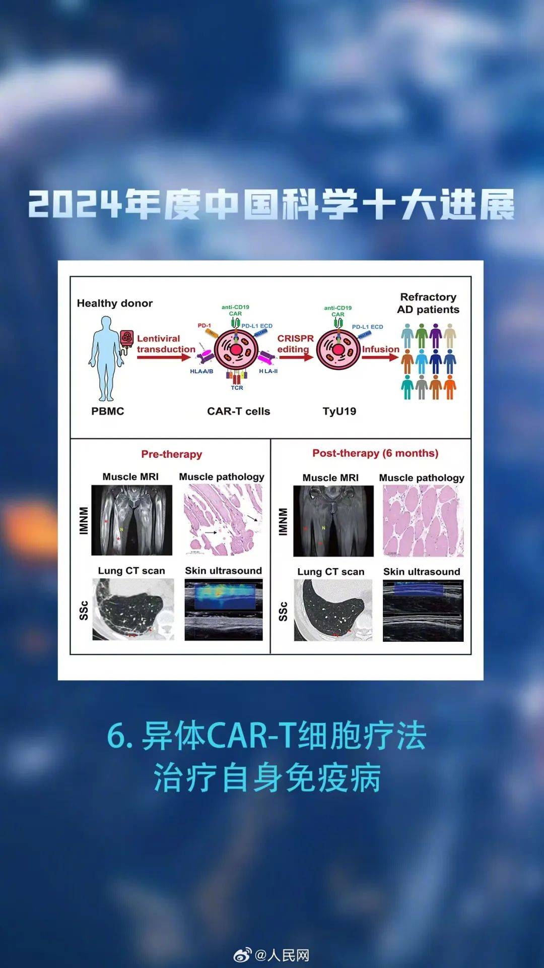 科学与健康|研判未来科技发展趋势，战略科学家们关心啥？