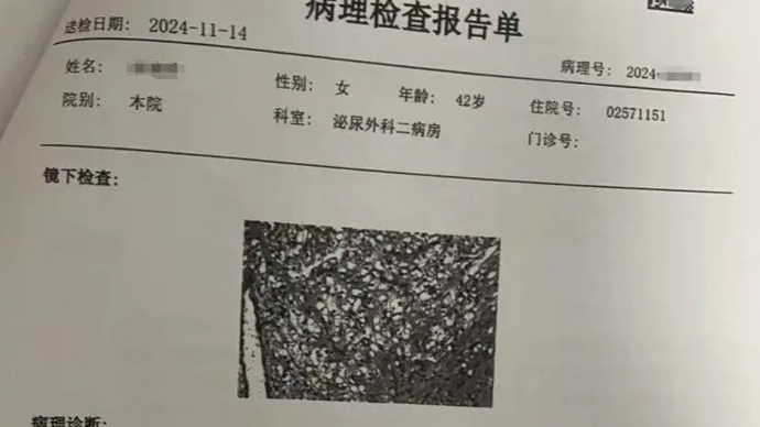 体检10年未预警癌症，爱康国宾卷入“假体检”风波，爱康集团门店数量不及竞对三分之一