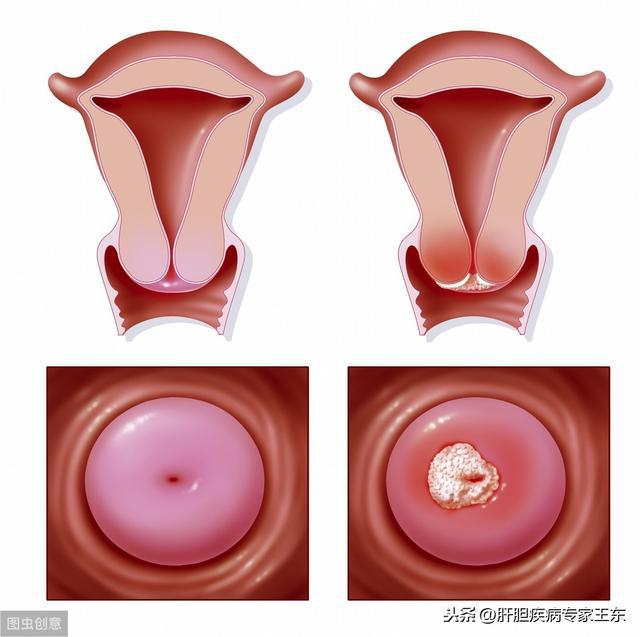 科华生物：肿瘤标志物检测试剂用于早期筛查