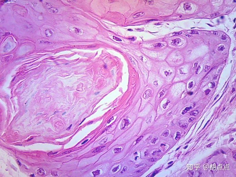 金域医学获得发明专利授权：“用于癌肉瘤评估切片及其制备方法和应用”