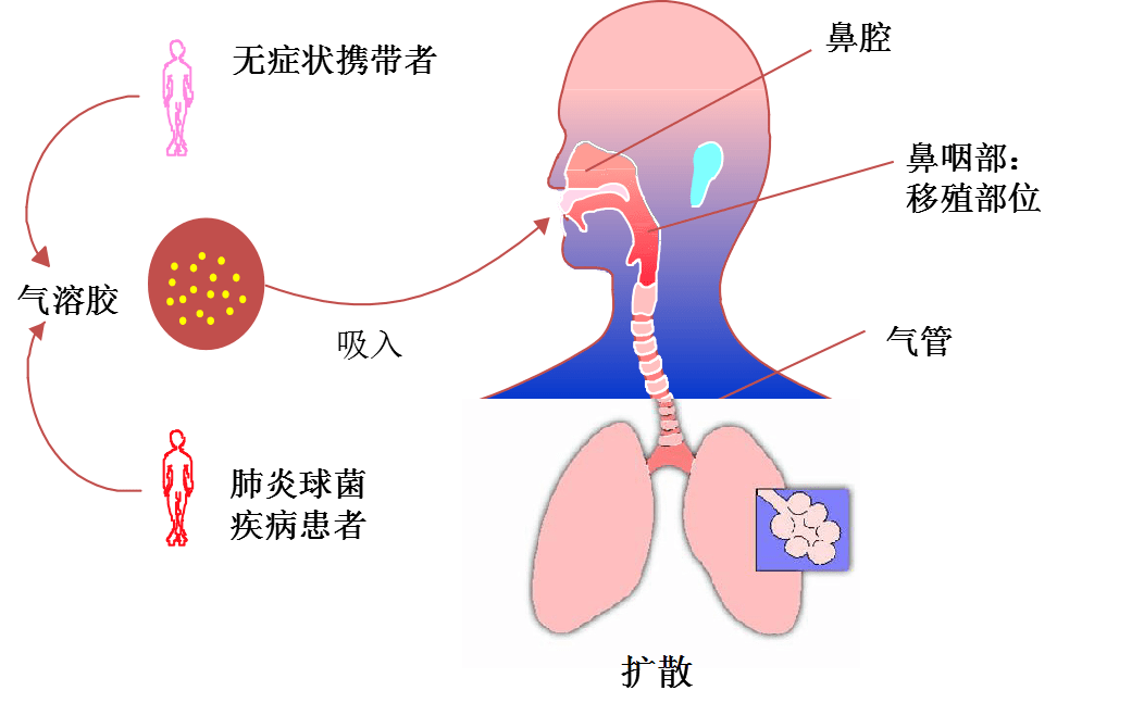 研究发现肺炎易感基因区域