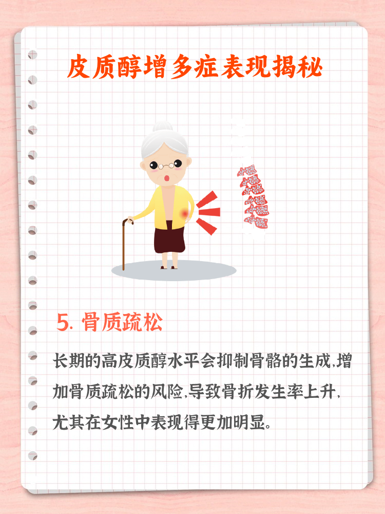 研究发现肥胖显著增加感染重症风险