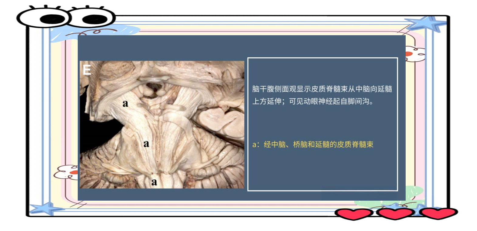 AI算法自动解析脑干白质神经束