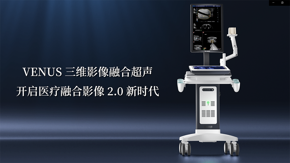开立医疗获得外观设计专利授权：“超声设备”