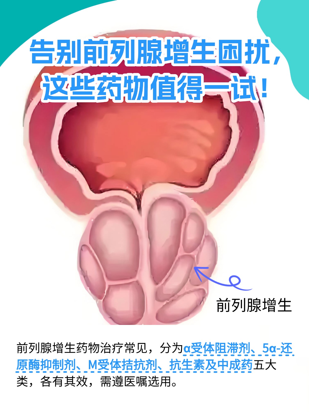 专家：中国快速迈入“深度老龄化社会”，多数患者对前列腺增生认知不足